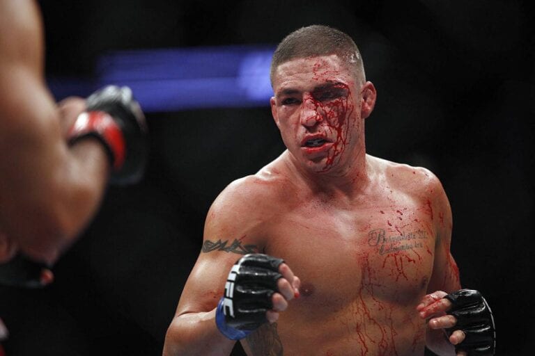 Diego Sanchez On Drop To Featherweight: When I Saw McGregor Do It, It Made Sense