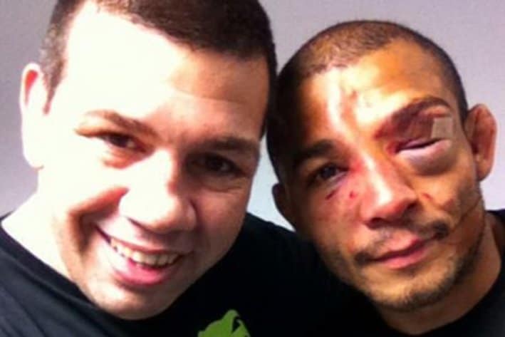 Jose Aldo's face after ufc 179