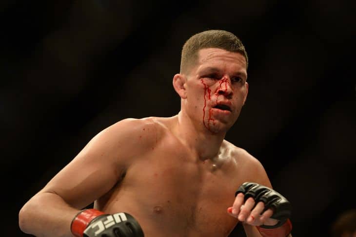Dana White On Nate Diaz: Get Your Head In The Game Or Retire