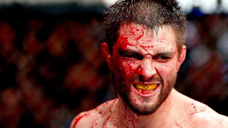 Carlos Condit Aiming To Return At UFC 187 In May