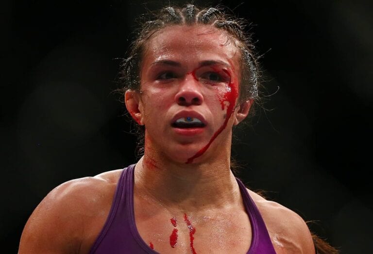 Claudia Gadelha Injured, Out Of UFC Fight Night 64