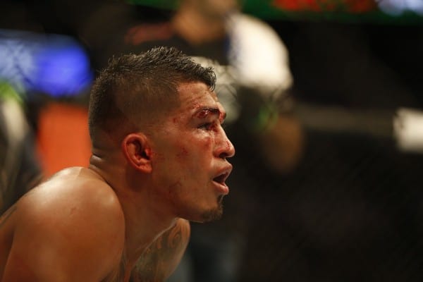 Anthony Pettis Injured Again, Replaced By Edson Barboza At UFC on FOX 16