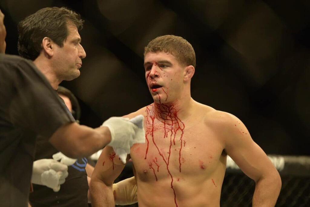 Five Reasons UFC Ratings Are Tanking In 2017 6 Al Iaquinta