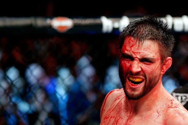 UFC Fight Night 67 Results: Carlos Condit Returns With Bloody Stoppage Of Thiago Alves 1 carlos condit