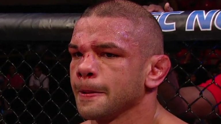 Video: Thiago Alves’ Broken Nose Will Most Likely Require Surgery