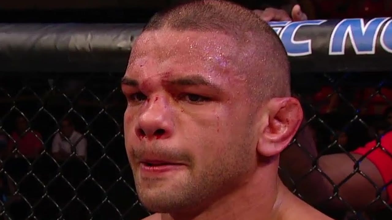 Video: Thiago Alves' Broken Nose Will Most Likely Require Surgery 1 maxresdefault 1