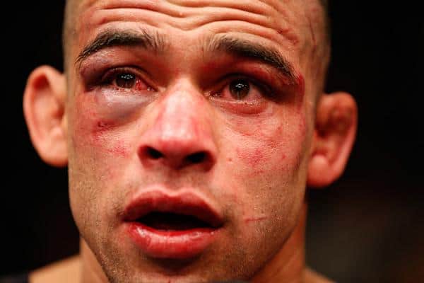 Dana White Talks Barao: When A Guy Loses A Certain Way, He’s Never The Same