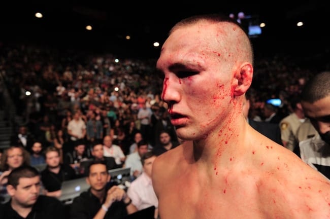 Rory MacDonald May Need Surgery After Breaking Nose Again