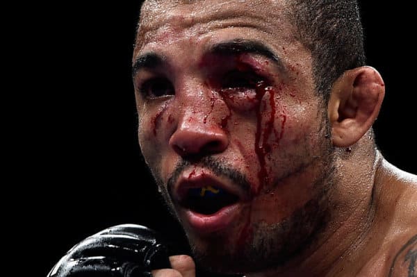 Report: Jose Aldo’s Random Drug Testers Did Have Valid Visas