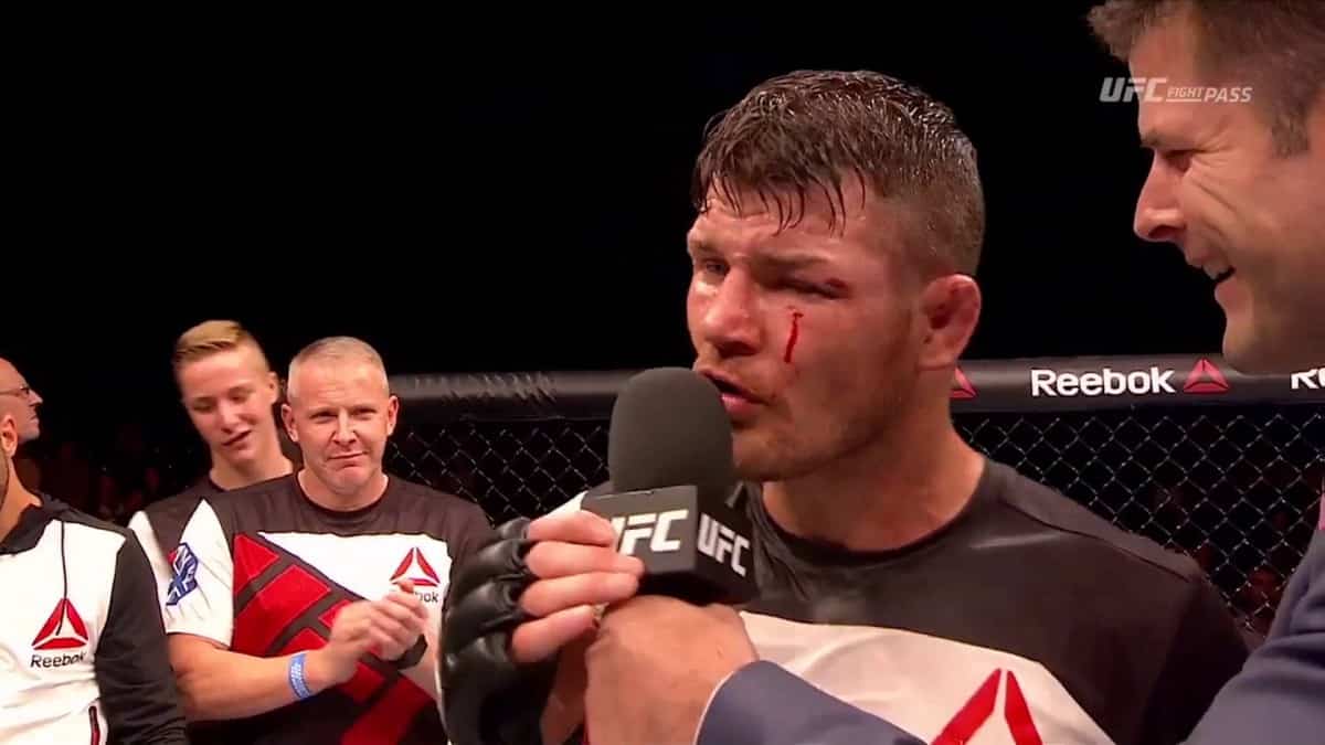 Video: Half Of Michael Bisping's Toe Hangs Off After Win Over Thales Leites 1