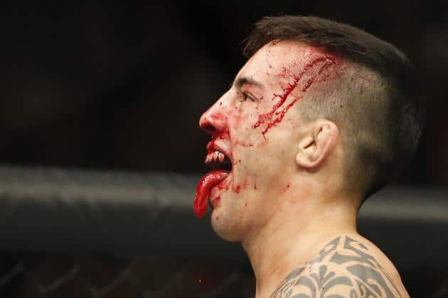 Five Fights To Make For Resurgent Bantamweight Division 6 Almeida 1