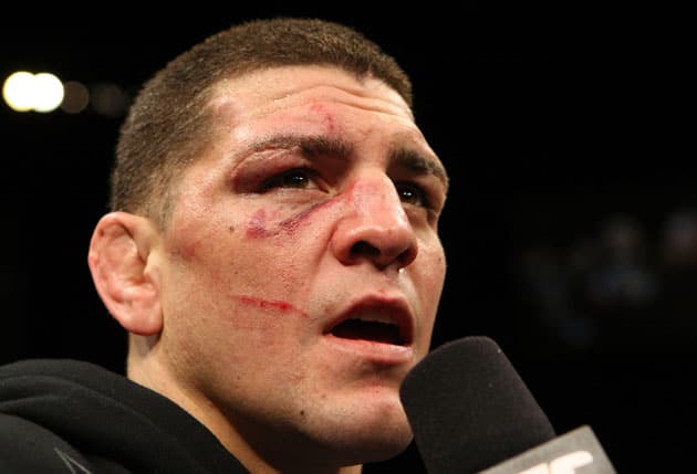 Nick Diaz Update: Cher, Wiz & 70,000 Signatures