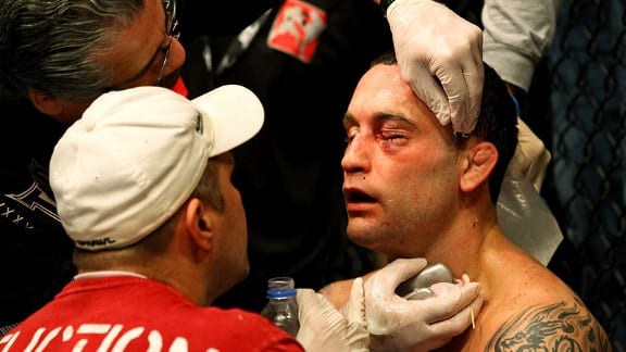 Frankie Edgar