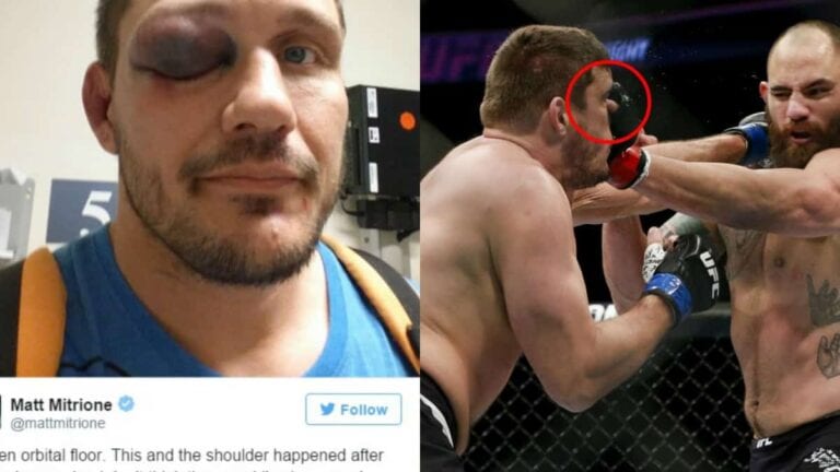 Matt Mitrione Reveals Full Extent Of Injury, Blames Eye Pokes