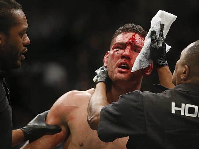 Chris Weidman Feels Loss Will Create “A Whole Different Monster”