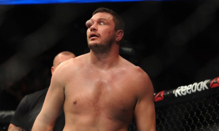 Graphic Images: Matt Mitrione Gets His Disgusting Eye Drained