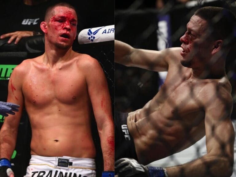 Pics: Is Nate Diaz Truly In Shape Like Dana White Said?