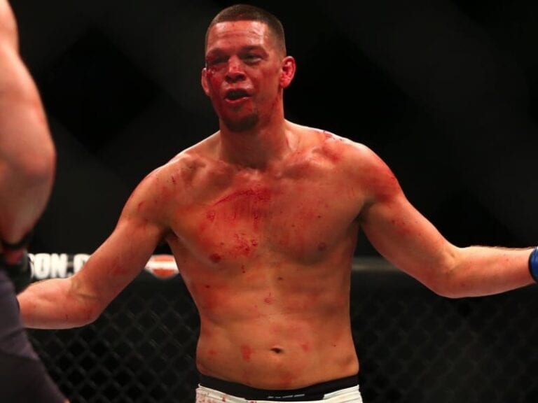 Nate Diaz: The UFC Should Hope I Lose At UFC 202