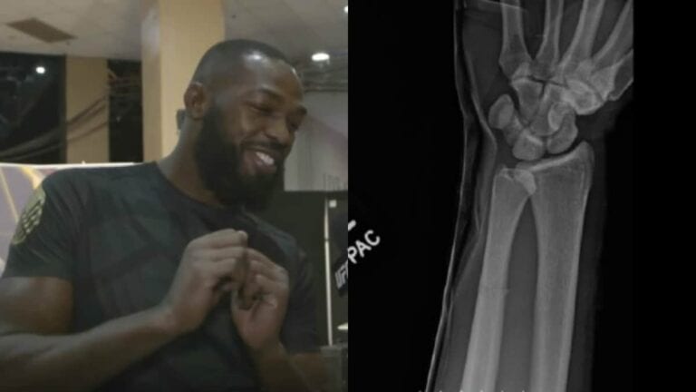 Jon Jones Broke OSP’s Arm, Watch His Reaction When He Finds Out