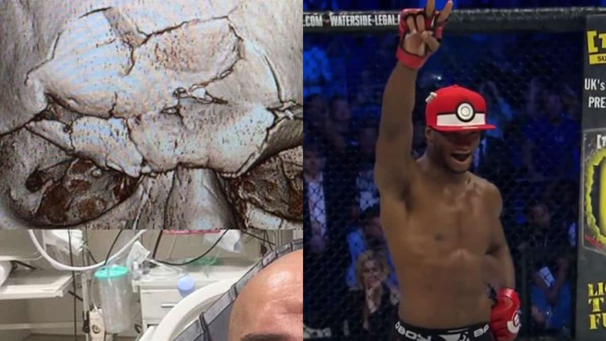 Pics Skull Was Literally Crushed By Michael Page's Knee