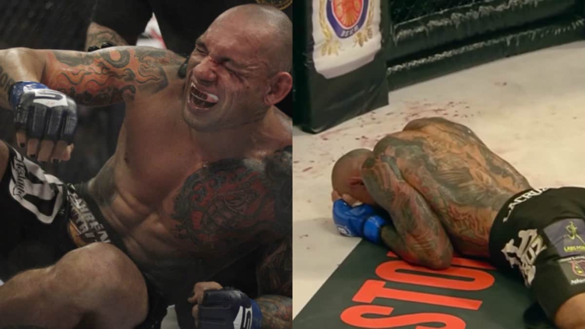 Santos Aims To Return Six Months After Fracturing Skull