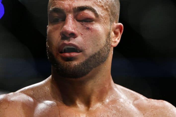 Eddie Alvarez Eye