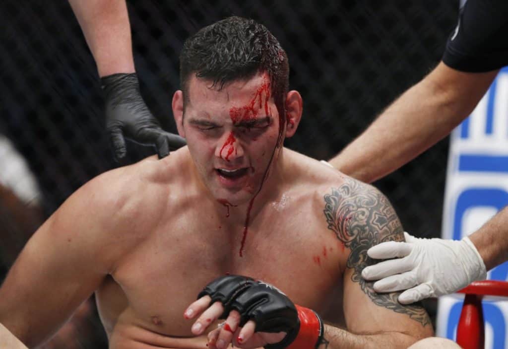 Best Of The Best: The Top 12 MMA Knockouts Of 2016 3 Mandatory Credit: Adam Hunger for USA TODAY Sports