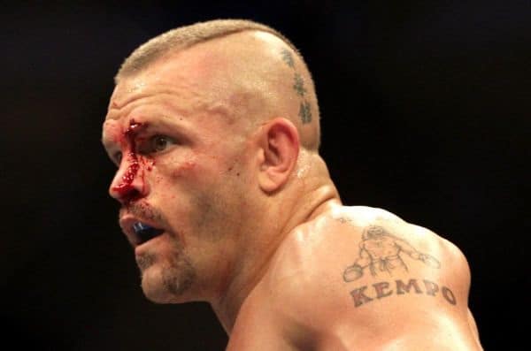 Chuck Liddell Beaten