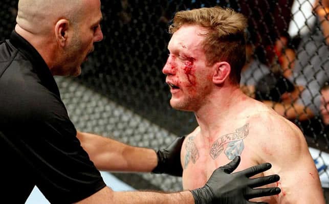 Gray Maynard injured