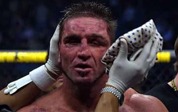 Ken Shamrock Beaten 3