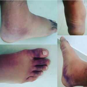 Foot
