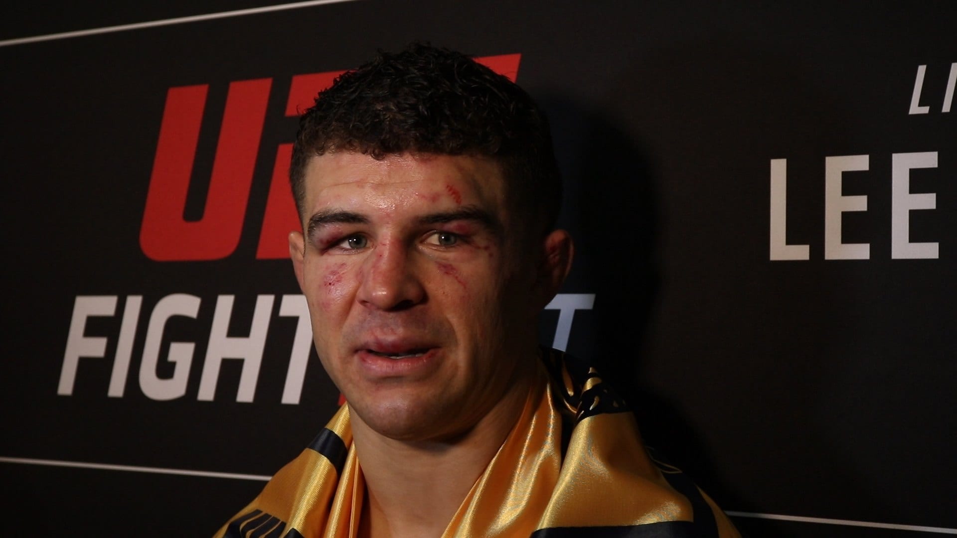 Al Iaquinta: I'm The "F**king Guy In This Division" 1 Al Iaquinta