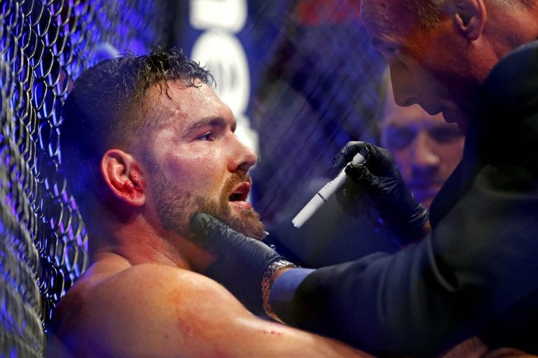 Chris Weidman Has No Regrets From Loss To Jacare Souza