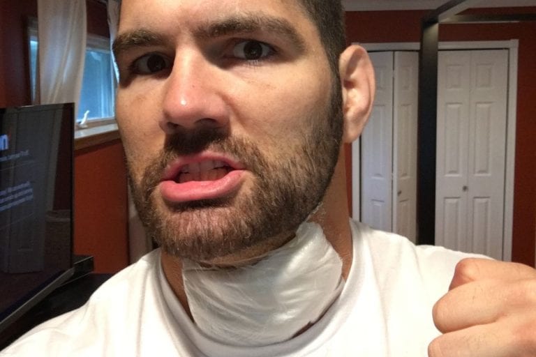 Chris Weidman Underwent ‘Unexpected Surgery’ On Wednesday