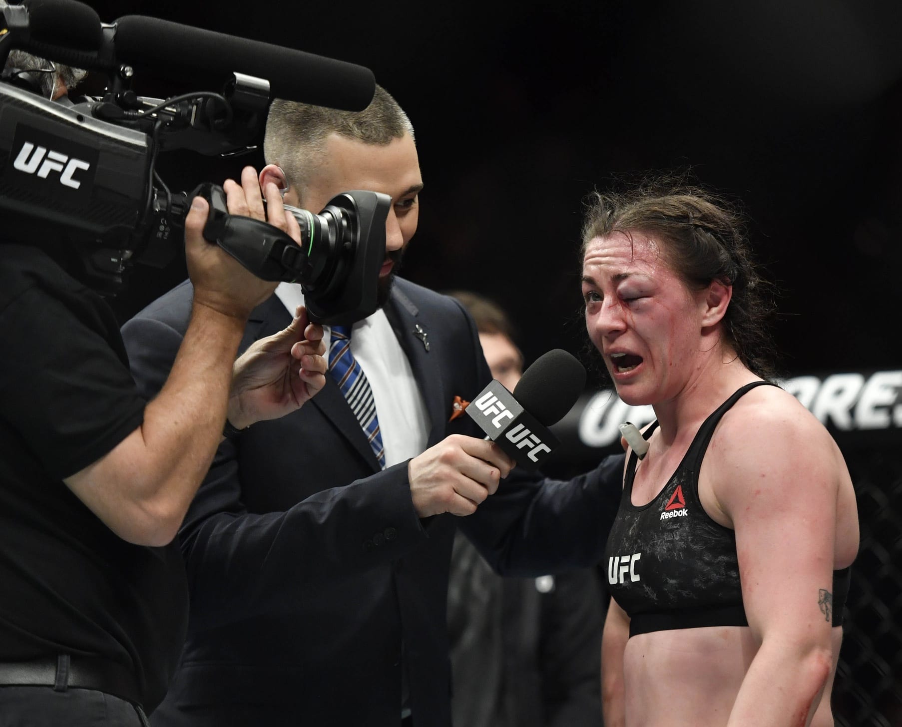 Video: Hometown Hero Molly McCann Suffers Gruesome Eye Injury In Emotional Victory 1 USATSI 12359914 168382968 lowres