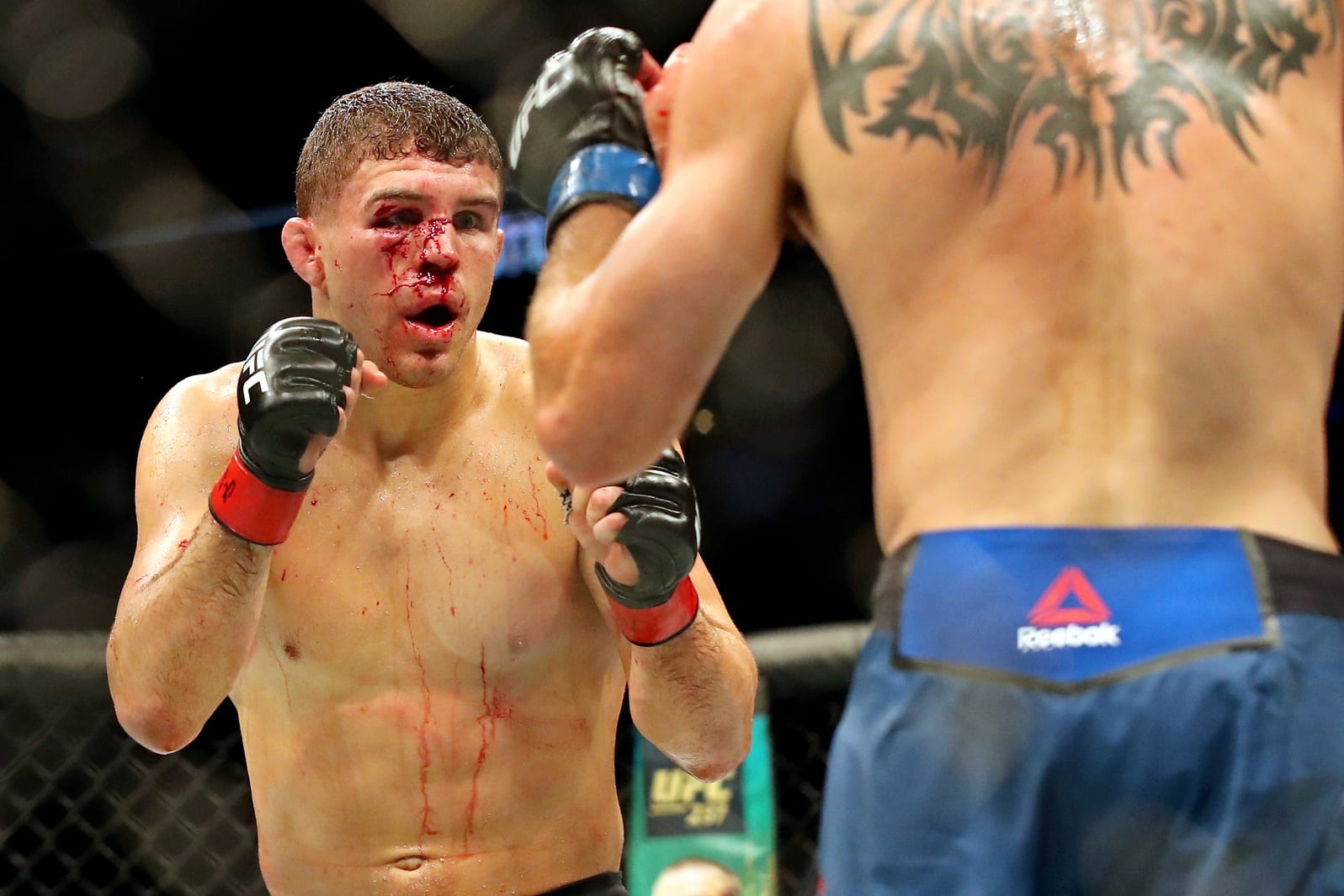UFC Ottawa Medical Suspensions: Al Iaquinta Gets Six Months 1 Al Iaquinta