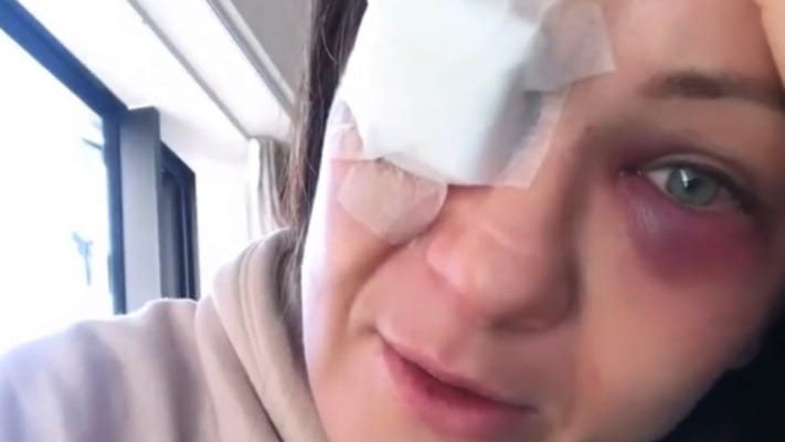 Karolina Kowalkiewicz To Undergo Operation Following Eye Injury