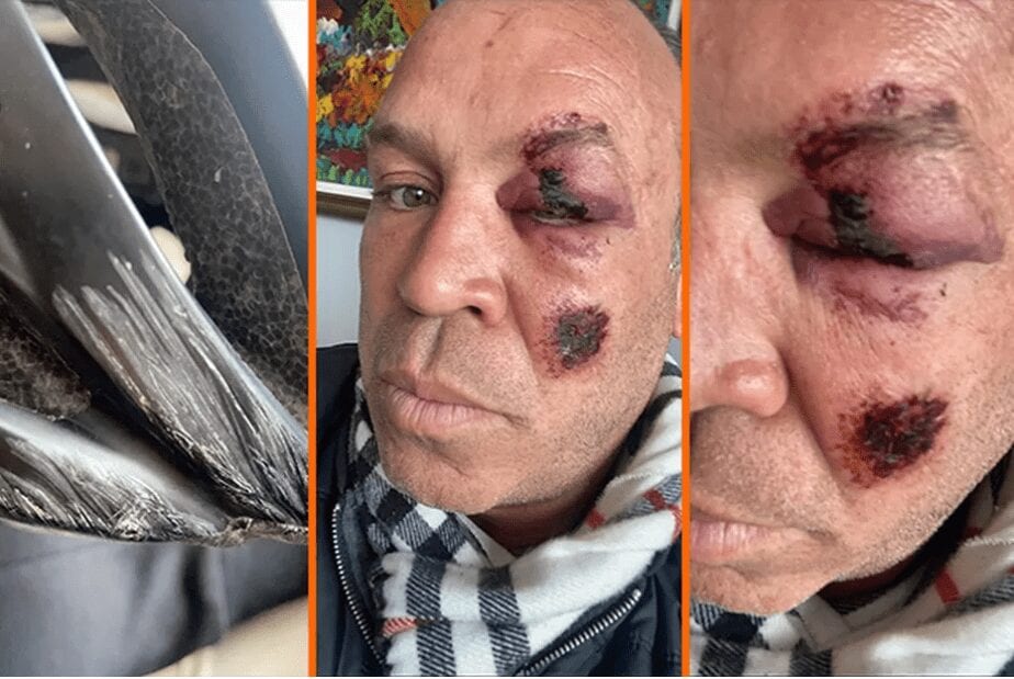 Wanderlei Silva Suffers Broken Foot After Being Hit By A Car In Brazil 2 Wanderlei