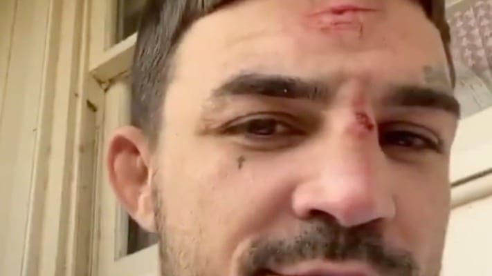 Mike Perry Displays A Number Of Cuts, Injuries On Body (Video)