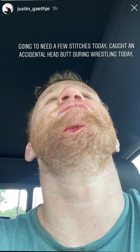 Justin Gaethje Shows Gruesome Cut From Head Butt In Training (Photo) 2 r3r3