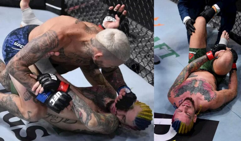 REPORT | Sean O’Malley Leg X-Ray ‘Came Back OK’