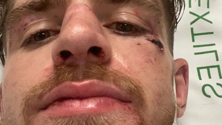 Edmen Shahbazyan Releases Statement Following Loss To Derek Brunson 1 Shahbazyan