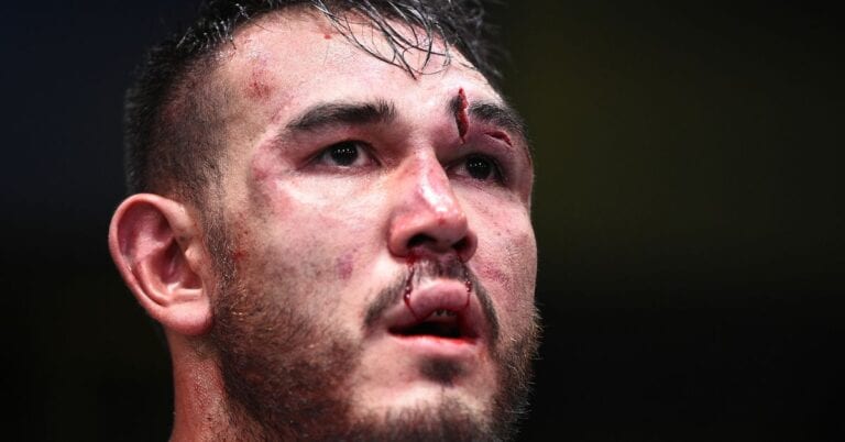 Report: Augusto Sakai Breaks, Dislocates Four Ribs  During Loss To Alistair Overeem