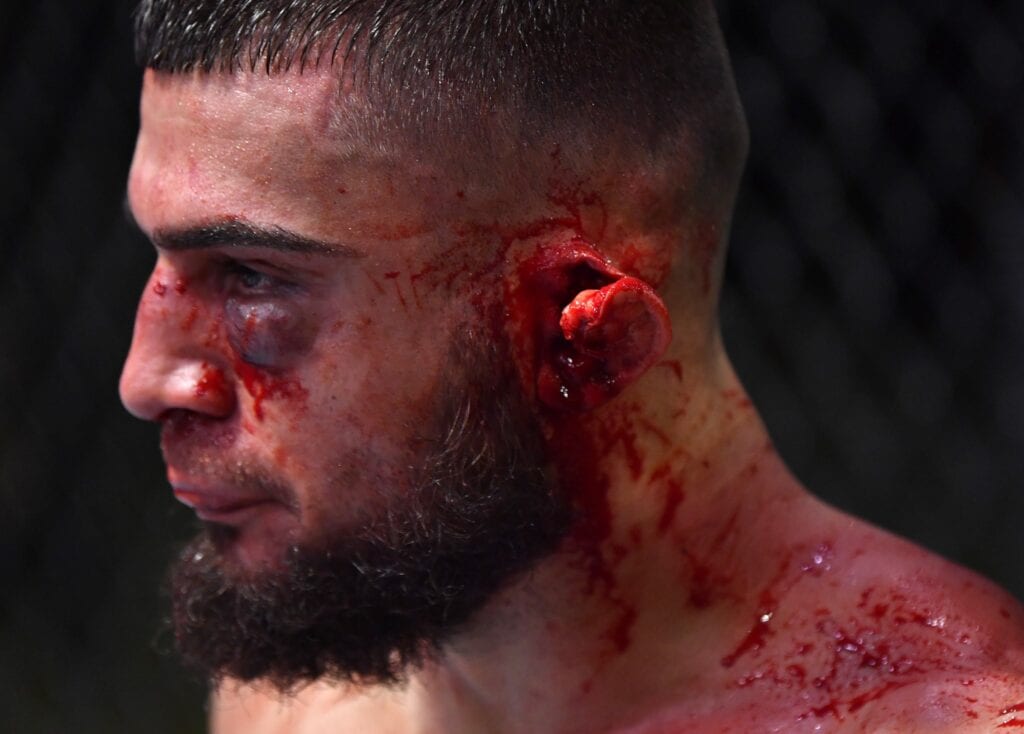 Ramiz Brahimaj Suffers Gruesome Ear Injury Against Max Griffin - UFC Vegas 13 Highlights 2 EmQ9mewVgAAhrYo