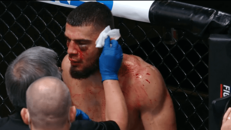 Ramiz Brahimaj Suffers Gruesome Ear Injury Against Max Griffin – UFC Vegas 13 Highlights