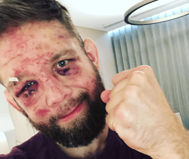 Nik Lentz Retires After UFC 257 Defeat, Cites Loss Of Vision