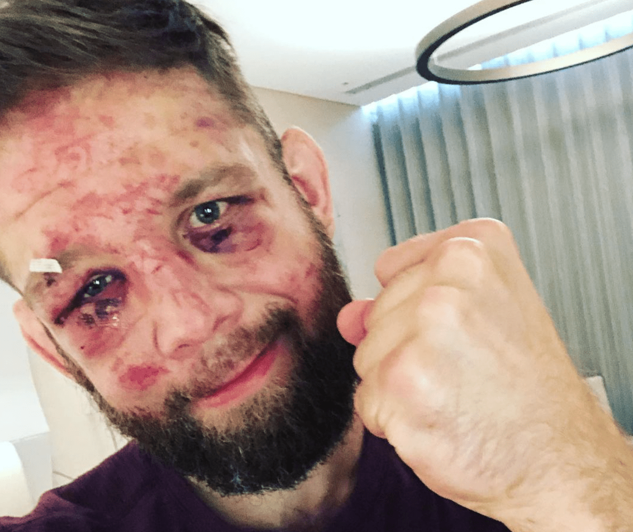 Nik Lentz Retires After UFC 257 Defeat, Cites Loss Of Vision 1 Lentz