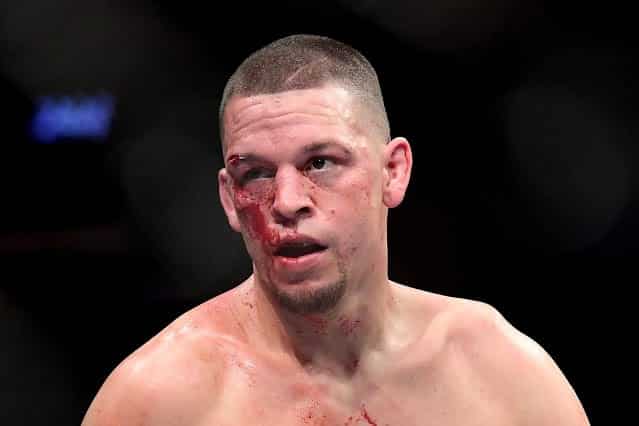 Nate Diaz Maintains Nobody Has Finished Him In The UFC
