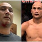 BJ Penn