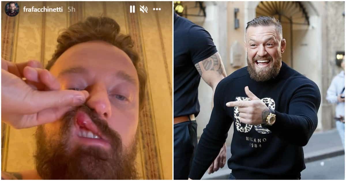Conor McGregor Accused Of Attacking Italian Musician In Rome 1 Conor McGregor